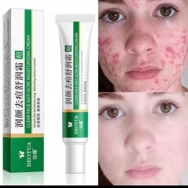 Krem nawilżający przeciwtrądzikowy Clear Face 091125-360