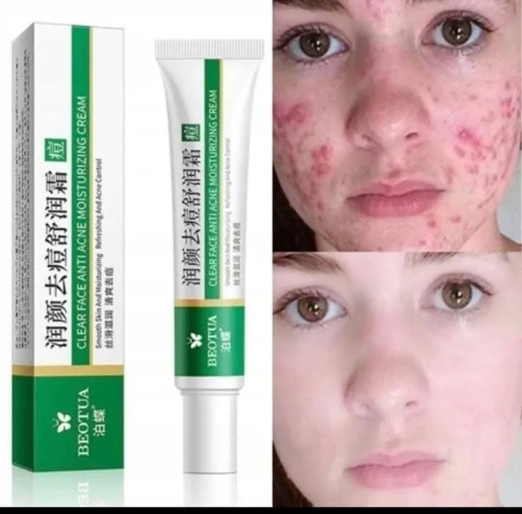 Krem nawilżający przeciwtrądzikowy Clear Face 091125-360