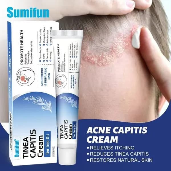 Krem na Grzybice Skóry Glowy 20gr