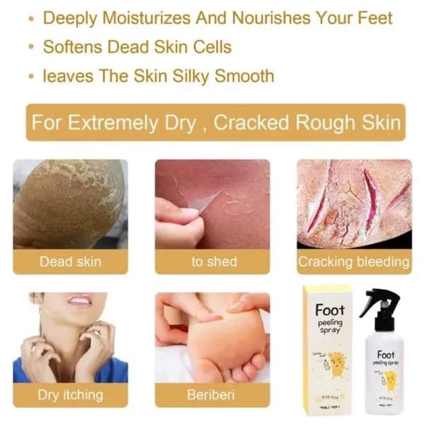 Peeling Do Stop W Sprayu 100ml