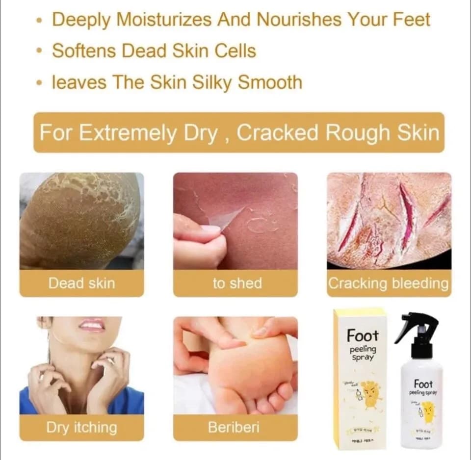 Peeling Do Stop W Sprayu 100ml